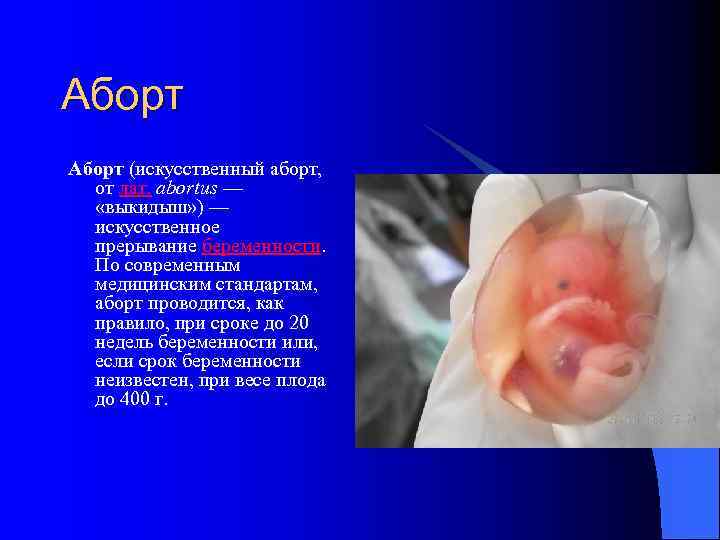 Аборт (искусственный аборт, от лат. abortus — «выкидыш» ) — искусственное прерывание беременности. По