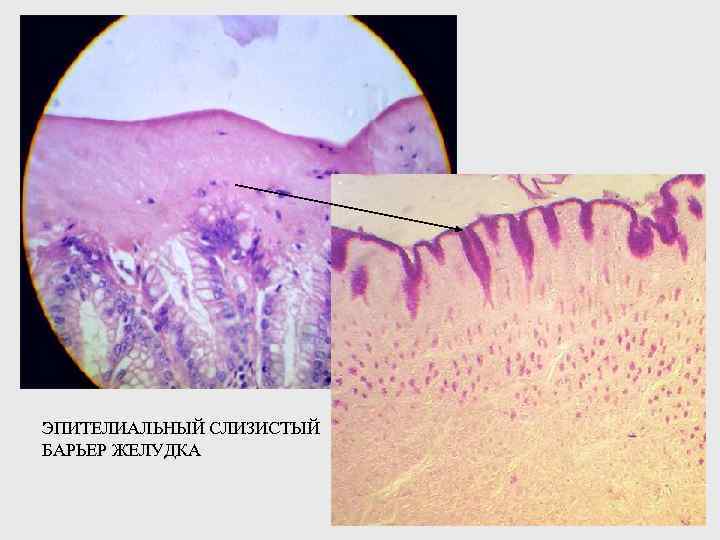 ЭПИТЕЛИАЛЬНЫЙ СЛИЗИСТЫЙ БАРЬЕР ЖЕЛУДКА 
