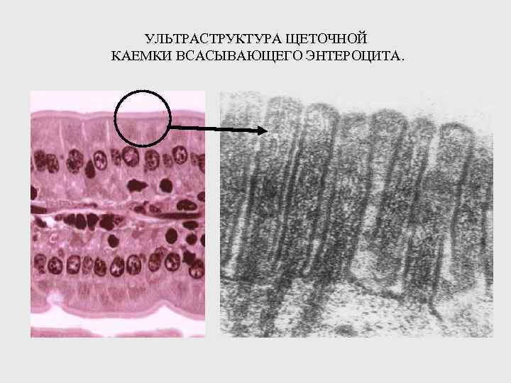 УЛЬТРАСТРУКТУРА ЩЕТОЧНОЙ КАЕМКИ ВСАСЫВАЮЩЕГО ЭНТЕРОЦИТА. 