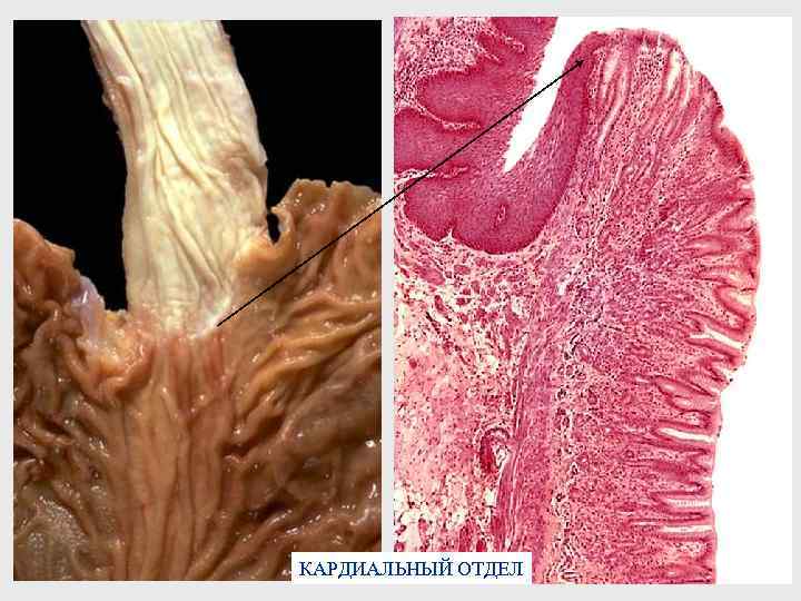 КАРДИАЛЬНЫЙ ОТДЕЛ 