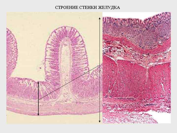 Стенки желудка. Структура стенки желудка. Стенки желудка анатомия. Желудок строение стенки желудка.