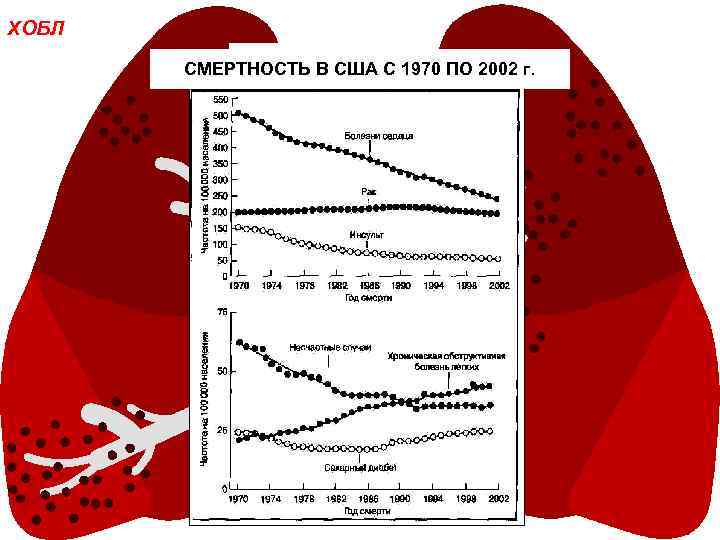 ХОБЛ СМЕРТНОСТЬ В США С 1970 ПО 2002 г. 