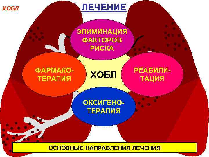ЛЕЧЕНИЕ ХОБЛ ЭЛИМИНАЦИЯ ФАКТОРОВ РИСКА ФАРМАКОТЕРАПИЯ ХОБЛ РЕАБИЛИТАЦИЯ ОКСИГЕНОТЕРАПИЯ ОСНОВНЫЕ НАПРАВЛЕНИЯ ЛЕЧЕНИЯ 