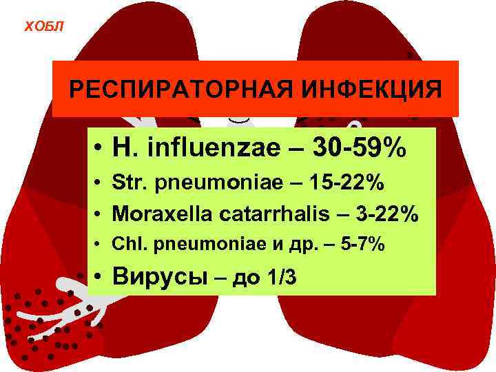 ХОБЛ РЕСПИРАТОРНАЯ ИНФЕКЦИЯ • H. influenzae – 30 -59% • Str. pneumoniae – 15