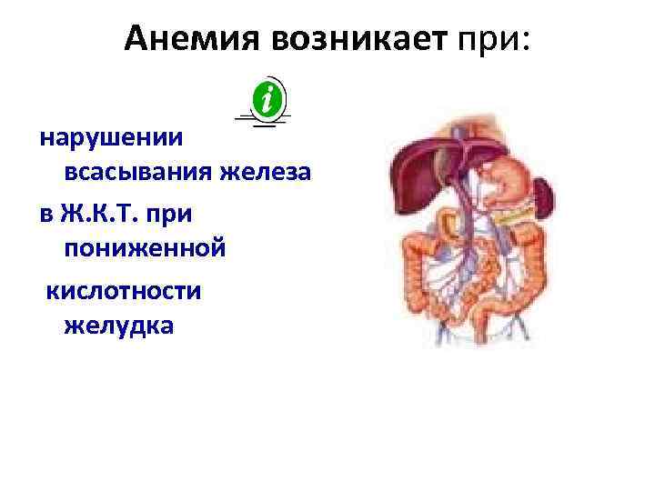Анемия возникает при: нарушении всасывания железа в Ж. К. Т. при пониженной кислотности желудка