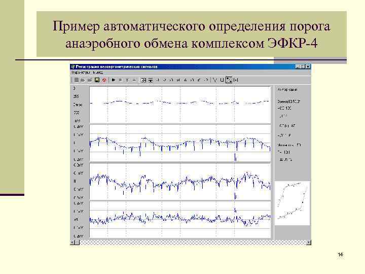 Пример автоматического определения порога анаэробного обмена комплексом ЭФКР-4 14 