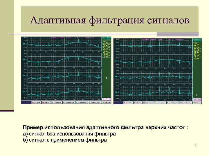 Сигнал без. Адаптивный фильтр. Адаптивные фильтры сигналов. Адаптивная фильтрация. Адаптивный цифровой фильтр это.