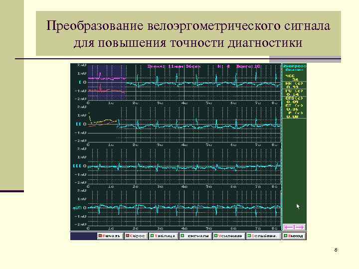 Преобразование велоэргометрического сигнала для повышения точности диагностики 8 