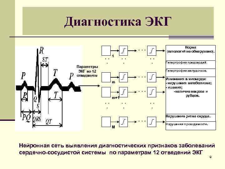 Диагностика ЭКГ Норма (патологий не обнаружено). . . 1. . . . Параметры ЭКГ