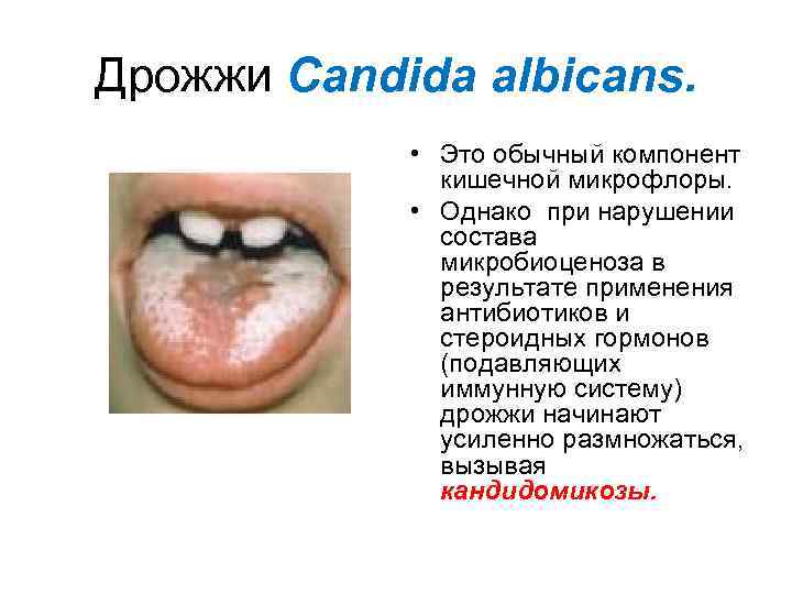 Дрожжи Candida albicans. • Это обычный компонент кишечной микрофлоры. • Однако при нарушении состава