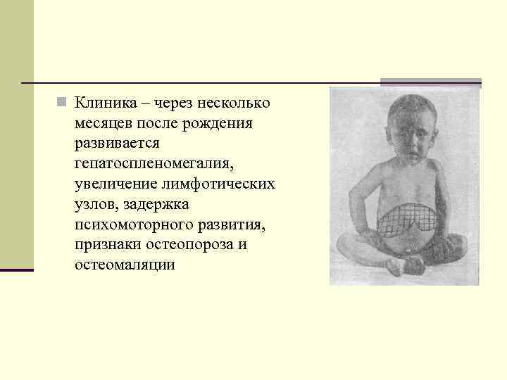 n Клиника – через несколько месяцев после рождения развивается гепатоспленомегалия, увеличение лимфотических узлов, задержка