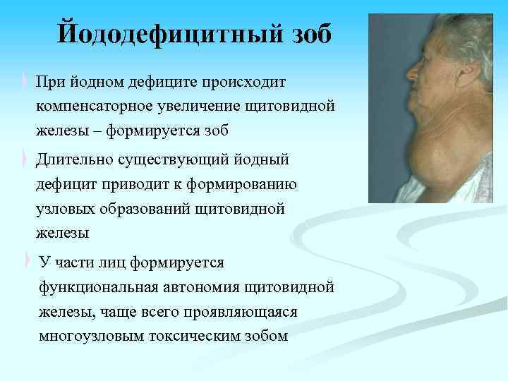 Йододефицитный зоб При йодном дефиците происходит компенсаторное увеличение щитовидной железы – формируется зоб Длительно