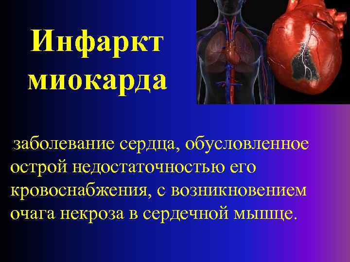 Инфаркт миокарда заболевание сердца, обусловленное острой недостаточностью его кровоснабжения, с возникновением очага некроза в
