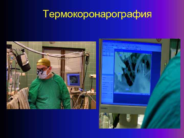 Термокоронарография 