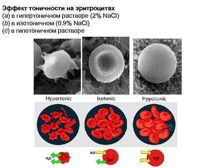 Эффект тоничности на эритроцитах (a) в гипертоничном растворе (2% Na. Cl) (b) в изотоничном