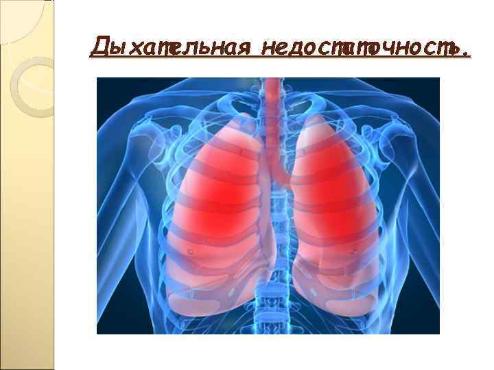 Дыхательная недостаточность. 