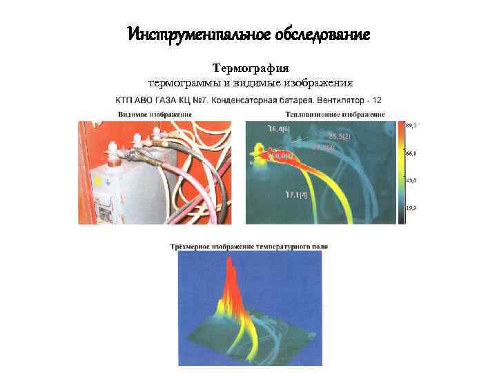 Инструментальное обследование Термография термограммы и видимые изображения 