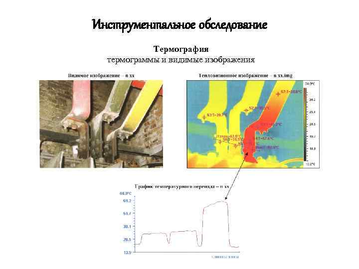 Инструментальное обследование Термография термограммы и видимые изображения 
