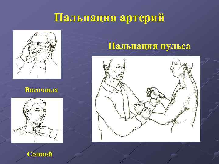 Пальпация артерий Пальпация пульса Височных Сонной 