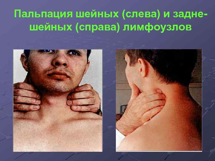 Пальпация шейных (слева) и заднешейных (справа) лимфоузлов 