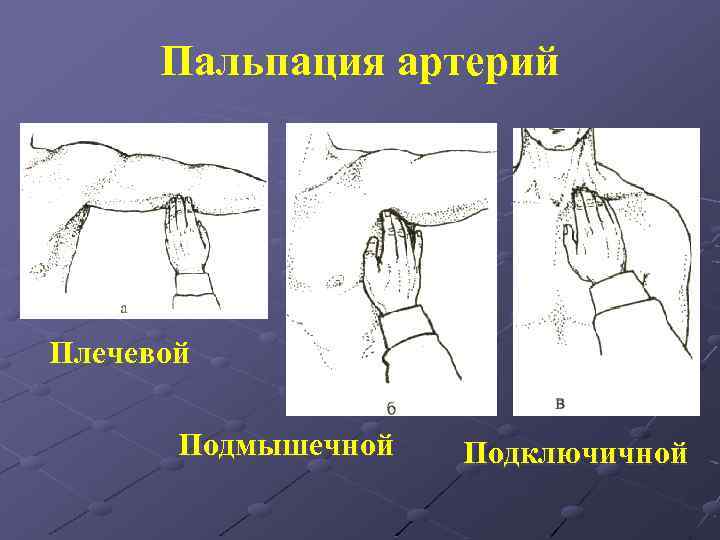 Пальпация артерий Плечевой Подмышечной Подключичной 