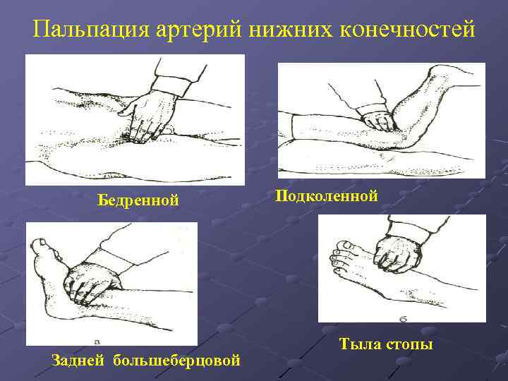 Пальпация артерий нижних конечностей Бедренной Задней большеберцовой Подколенной Тыла стопы 