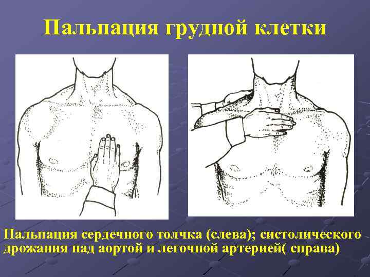 Пальпация грудной клетки Пальпация cердечного толчка (слева); систолического дрожания над аортой и легочной артерией(