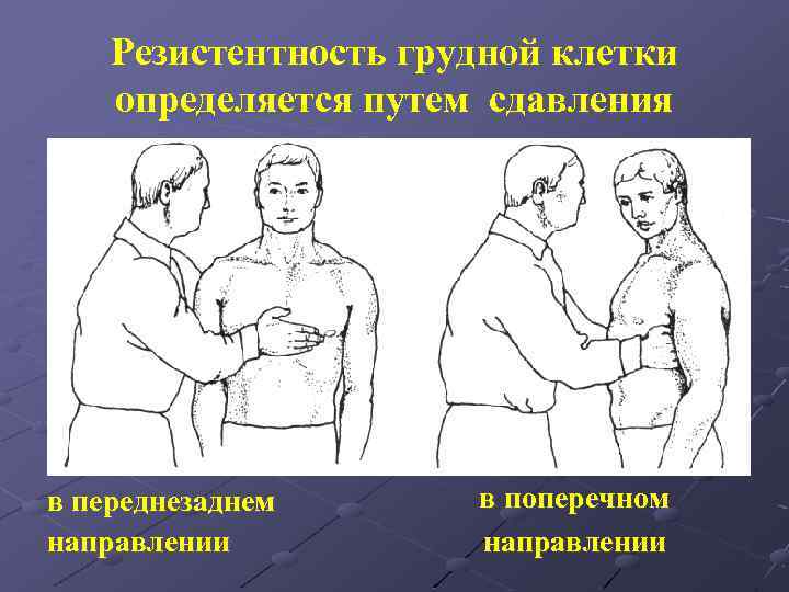 Резистентность грудной клетки определяется путем сдавления в переднезаднем направлении в поперечном направлении 