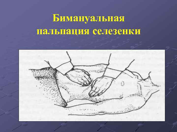 Бимануальная пальпация селезенки 