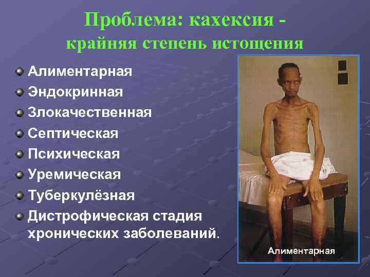 Проблема: кахексия крайняя степень истощения Алиментарная Эндокринная Злокачественная Септическая Психическая Уремическая Туберкулёзная Дистрофическая стадия