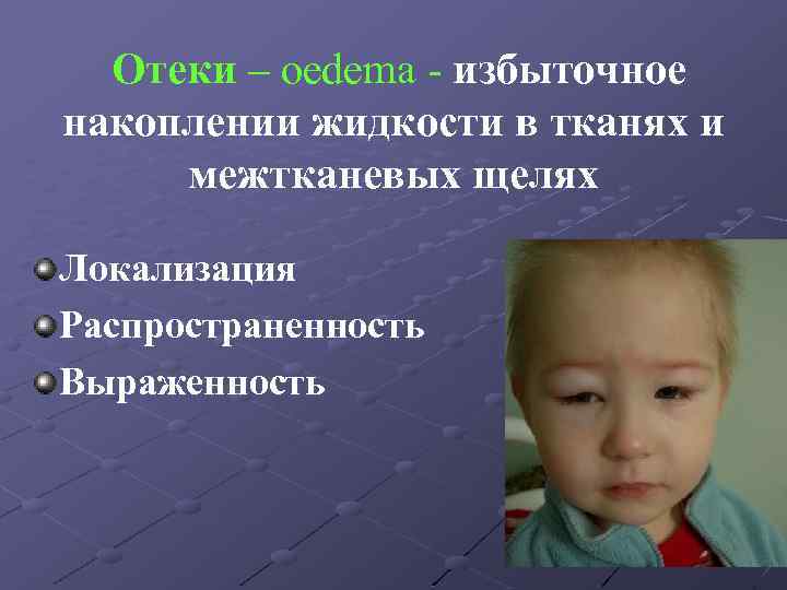 Отеки – oedema - избыточное накоплении жидкости в тканях и межтканевых щелях Локализация Распространенность
