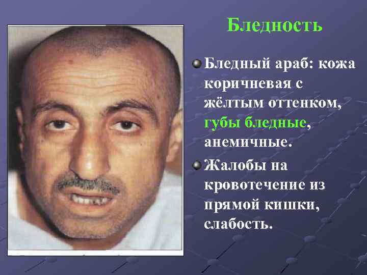Бледность Бледный араб: кожа коричневая с жёлтым оттенком, губы бледные, анемичные. Жалобы на кровотечение