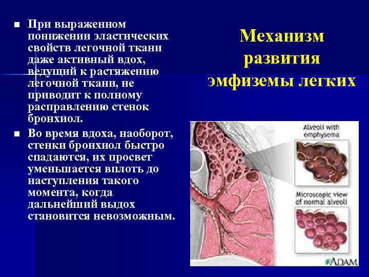 Стул болотная тина при каком заболевании