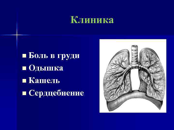 Клиника n Боль в груди n Одышка n Кашель n Сердцебиение 