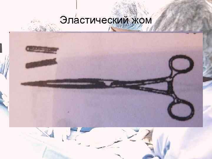 Эластический жом 