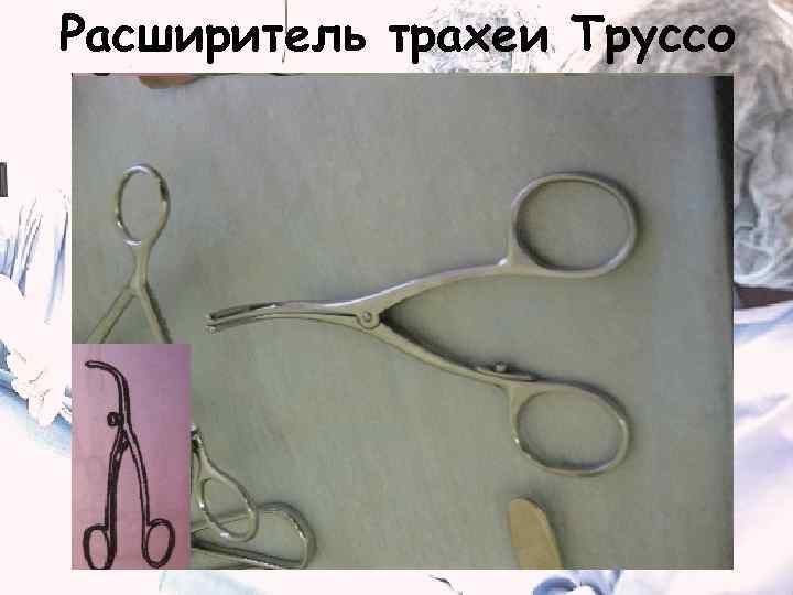 Расширитель трахеи Труссо 