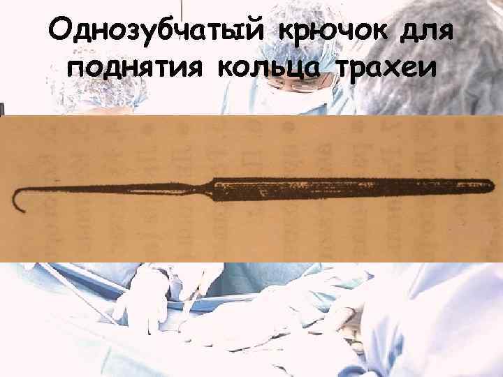 Однозубчатый крючок для поднятия кольца трахеи 