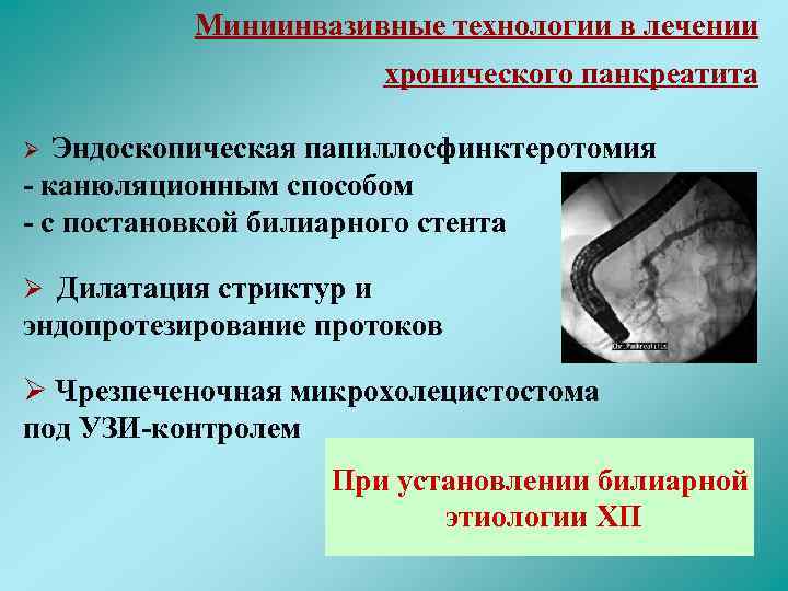 Хирургическое лечение хронического панкреатита. Миниинвазивные технологии в лечении хронического панкреатита. Малоинвазивные операции при хроническом панкреатите. Эндоскопические операции при панкреатите. Консервативная терапия хронического панкреатита.