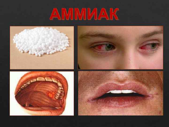 АММИАК 