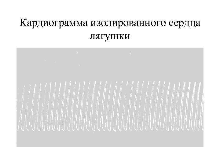 Кардиограмма изолированного сердца лягушки 