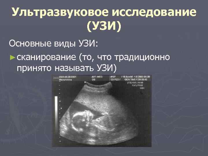 Виды узи. Виды исследований УЗД. Виды ультразвуковых исследований. Ультразвуковые методы исследования виды.