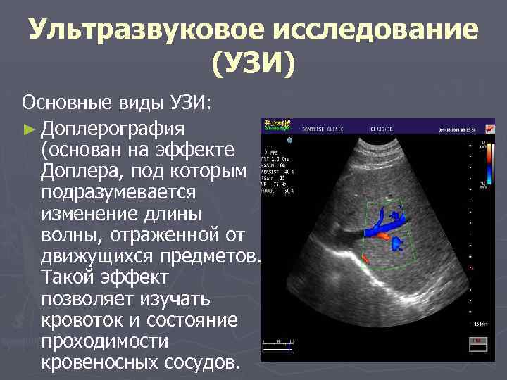 Как называется узи