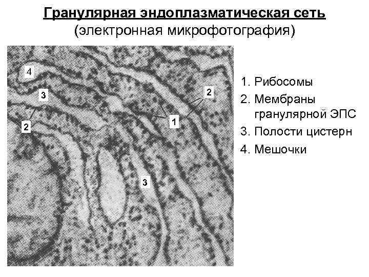 Какова функция органоида электронная микрофотография которого представлена на рисунке