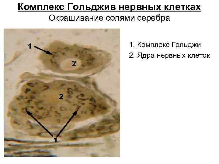 Комплекс Гольджив нервных клетках Окрашивание солями серебра 1. Комплекс Гольджи 2. Ядра нервных клеток