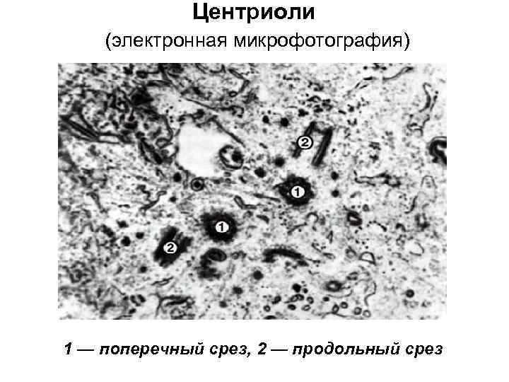 Какова функция органоида электронная микрофотография которого представлена на рисунке