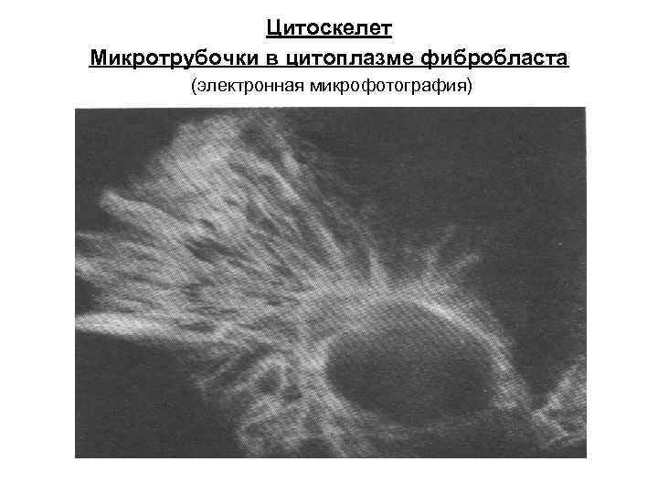 Цитоскелет Микротрубочки в цитоплазме фибробласта (электронная микрофотография) 