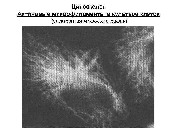 Цитоскелет Актиновые микрофиламенты в культуре клеток (электронная микрофотография) 