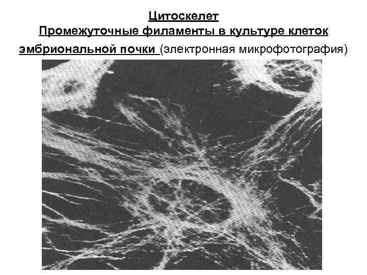 Цитоскелет Промежуточные филаменты в культуре клеток эмбриональной почки (электронная микрофотография) 