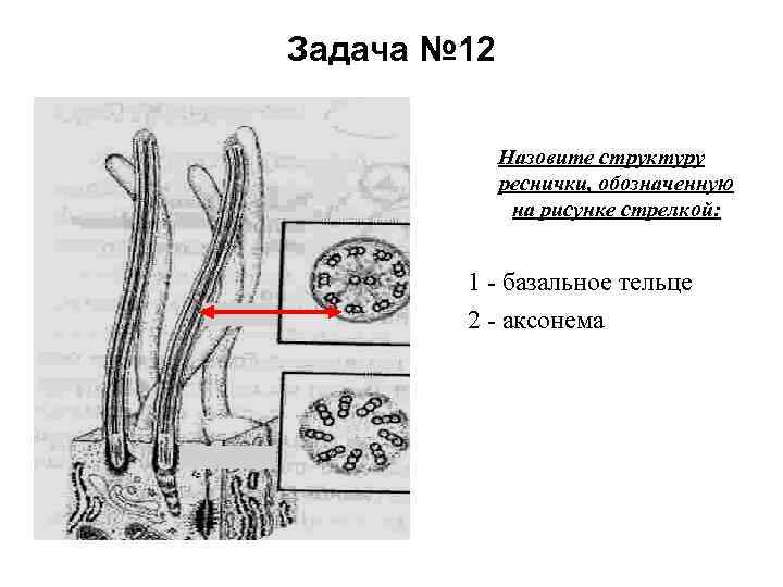 Задача № 12 Назовите структуру реснички, обозначенную на рисунке стрелкой: 1 - базальное тельце