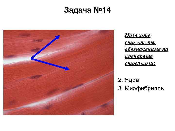 Задача № 14 Назовите структуры, обозначенные на препарате стрелками: 2. Ядра 3. Миофибриллы 
